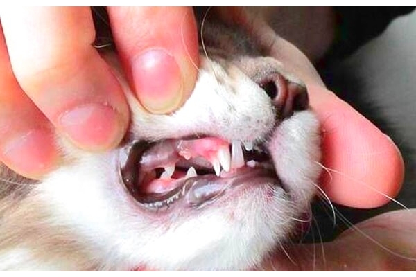 Удаление молочного зуба 