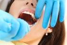 Удаление зуба сложное с разъединением корней