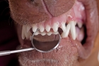 Удаление молочных зубов 